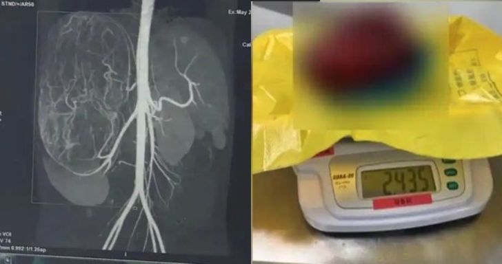 17-year-old girl tries on clothes